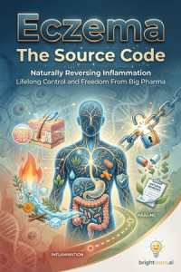 Eczema: The Source Code for Naturally Reversing Inflammation from the Inside Out book cover